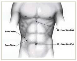 Slider image (3) Panama Gastric Surgery Center